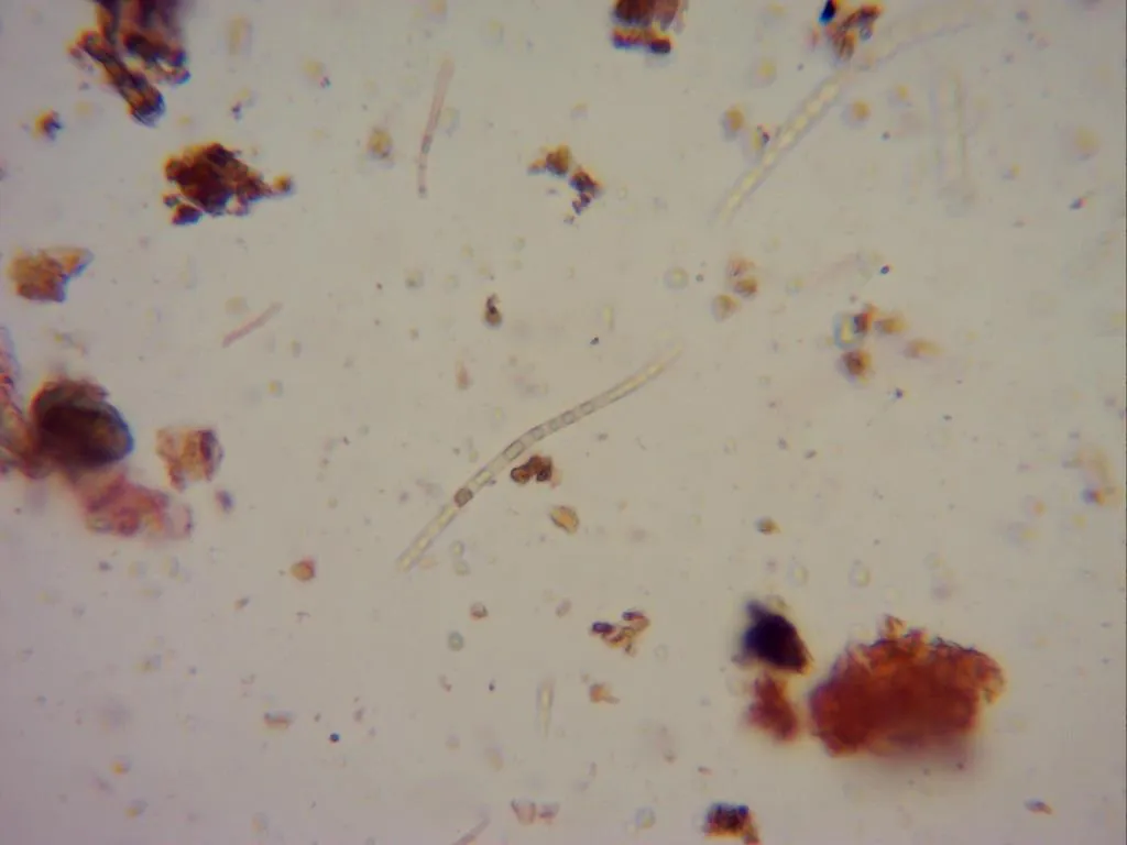 Microscopía de Sillia ferruginea - 6 -  X 400